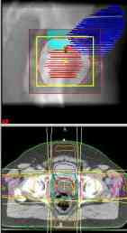 3d_prostate.jpg (4961 bytes)