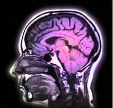 brain_color2.jpg (7493 bytes)