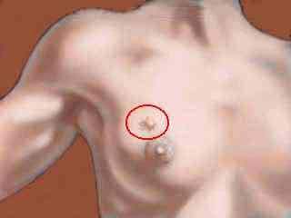 breast_margins_pic.jpg (4201 bytes)