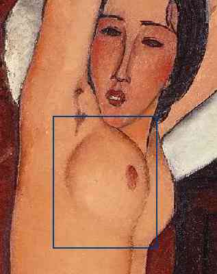 breast_modern_port.jpg (12359 bytes)