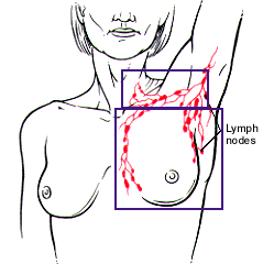 breast_nodes_fdsite_port.gif (10585 bytes)