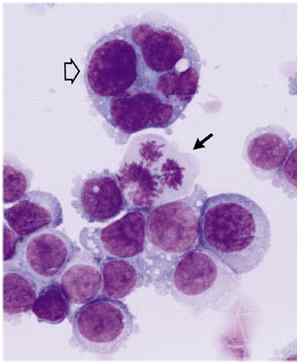 cancer_cells.jpg (9148 bytes)