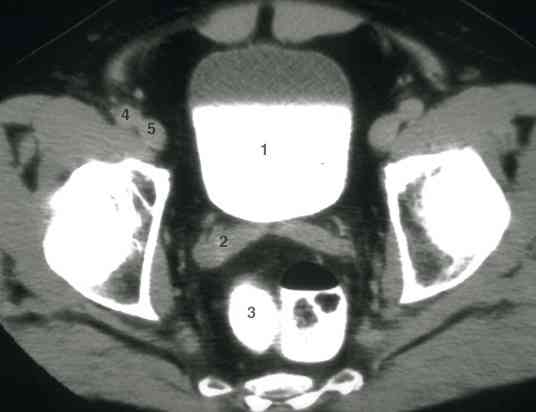 ct_semves1.jpg (13456 bytes)