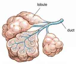 dcis1.jpg (5706 bytes)