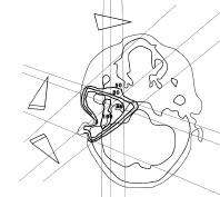 ear_ct_plan.gif (6373 bytes)