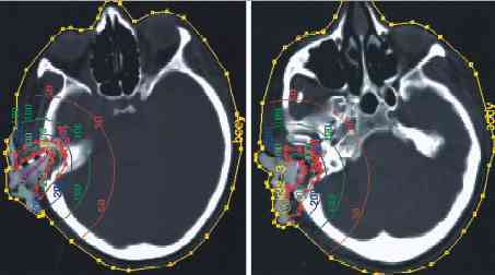 ear_ct_plan.jpg (12453 bytes)