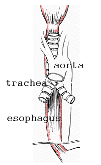 esoph4.gif (12672 bytes)