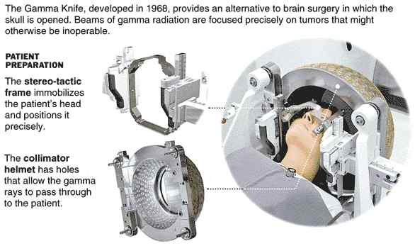 What is Gamma knife surgery?