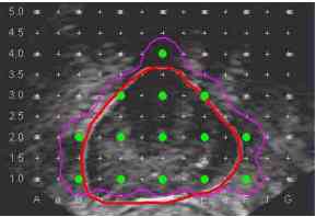 grid2.jpg (6829 bytes)