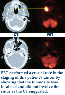 head-neck_pet.gif (34470 bytes)