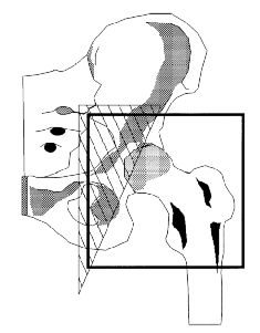 heterotopic_port1.gif (11117 bytes)