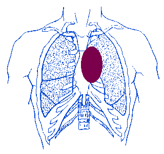 lung_III.gif (6377 bytes)