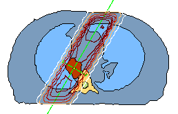 lung_port.gif (5049 bytes)