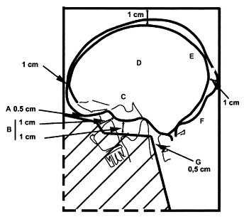 medullo_carrie1.gif (10695 bytes)