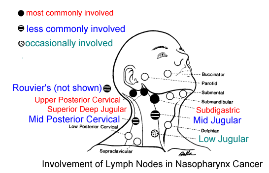 Nasopharynx Cancer Anatomy And Images
