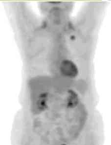 pet_breast1.jpg (3492 bytes)