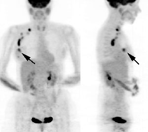 pet_breast2.jpg (15305 bytes)