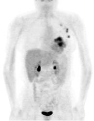 pet_breast3c.jpg (13117 bytes)