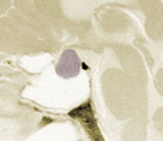 pituitary_bmc_sh.jpg (8160 bytes)