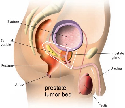 Female testosterone supplement