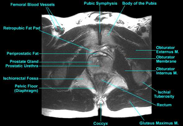 prostate mri anatomy radiographics