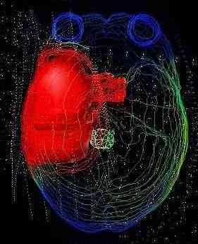 rahd_brain.jpg (34550 bytes)