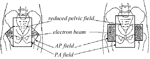 rtog_anal1.gif (11231 bytes)