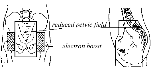 rtog_anal2.gif (8894 bytes)