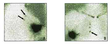 sentinel_node.jpg (6362 bytes)