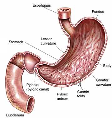 cancer of gastric antrum)